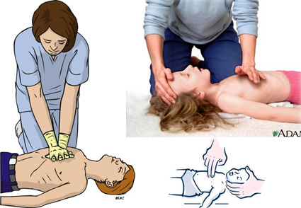 photo:  resuscitation-guidelines.articleinmotion.com -  www.mybwmc.org - www.firstaid.ph