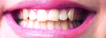 teeth-1ab