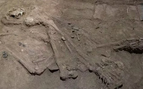 Στη φωτογραφία εικονίζεται ο σκελετός του ανθρώπου στον οποίο έγινε η επέμβαση στο πόδι πριν από 31 χιλιάδες έτη. - Photo; Tim Maloney