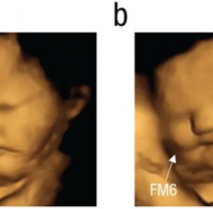 FETAL AND NEONATAL RESEARCH LAB/DURHAM UNIVERSITY/PSYCHOLOGICAL SCIENCE